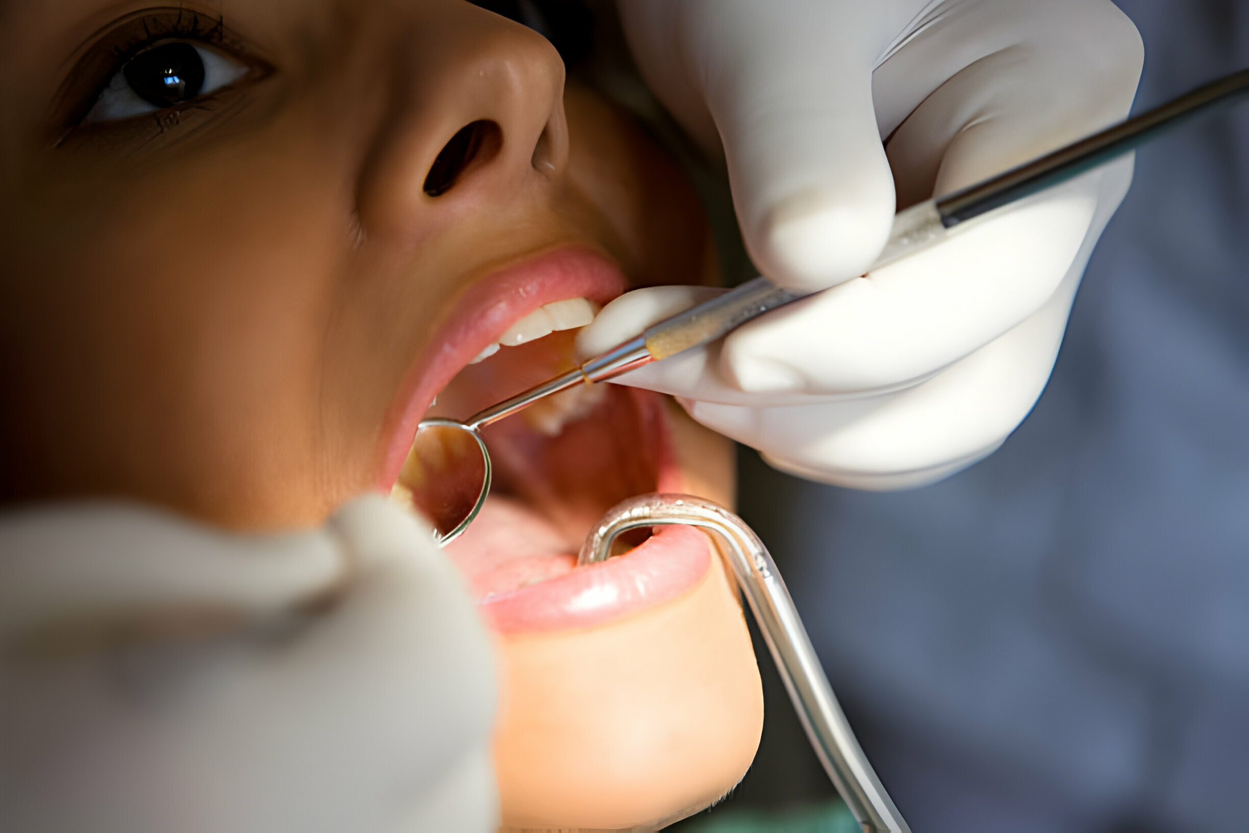 Preparing for Your Dental Crown Procedure: What to Expect?_3