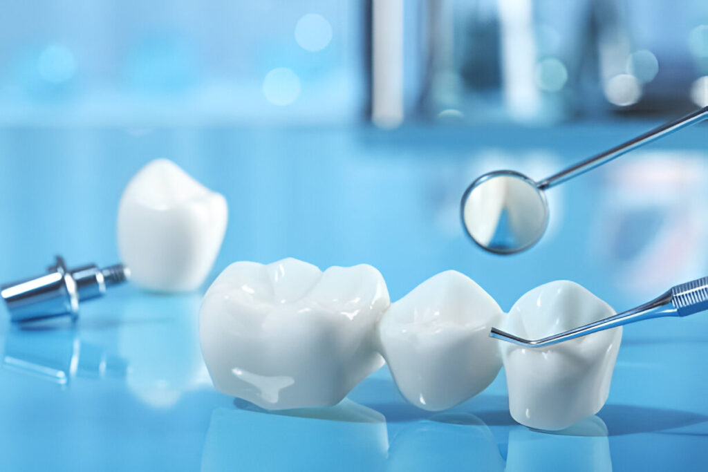 How Gentle Dentistry of Las Colinas Specializes in Replacing Dental Bridges in Irving, Texas_FI